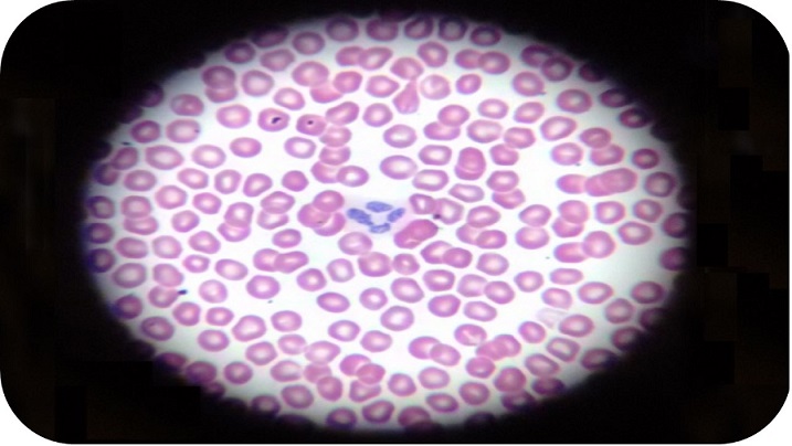 Microscopio simple. Mucho más que una simple lupa